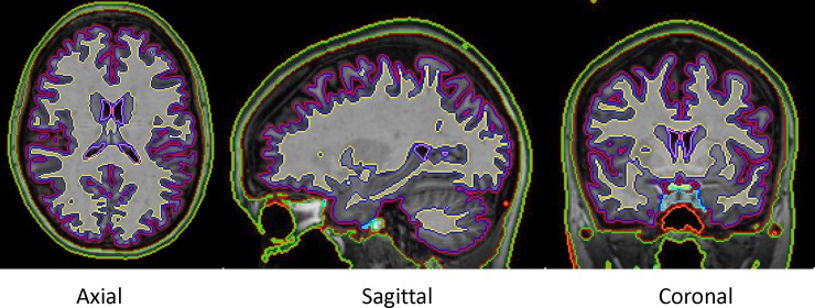 Fig 3