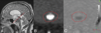Fig 3.