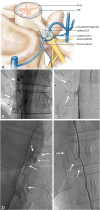 Fig 4.