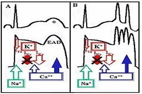 Figure 1A