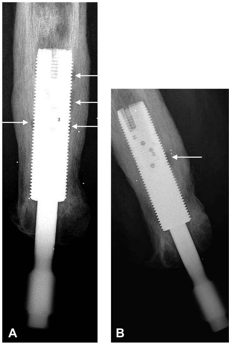 Fig. 2A–B