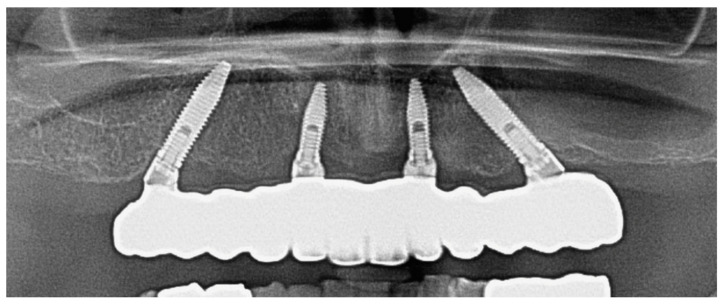 Figure 13