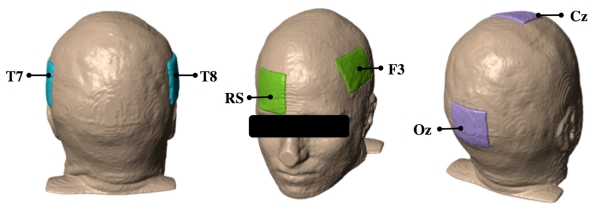 Fig. 4