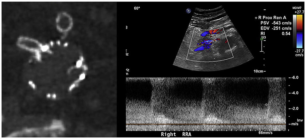 Fig 3.