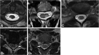 FIG 4.