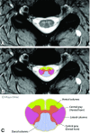 FIG 2.
