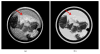 Fig. 11