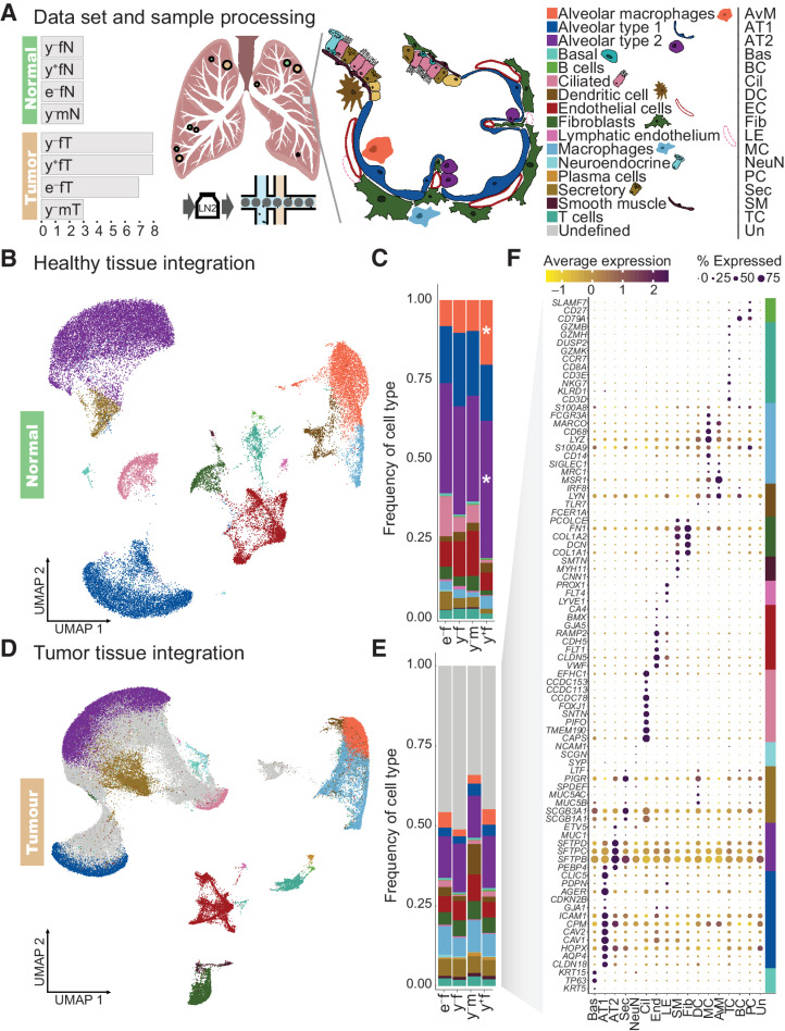 Figure 1. Cell type composition of normal lung and LUAD. A, Schematic overview of the samples and cell types of the alveoli. We analyzed 38 fresh frozen retrospective surgical samples from 26 patients, including 26 tumor samples (•) and 12 matching normal lung samples (•) from female (f) and male (m) patients. Dot size is indicative for number of samples obtained in one region (compare Supplementary Table S2). They comprised two different age cohorts, labelled young (y, 40–60 years) and elderly (e, 75–90 years). Patients are divided in smokers (+) and never smokers (-). Single-nucleus RNA-Seq libraries were prepared from all samples. B, UMAP representation of integrated normal lung transcriptome data. C, Cell type proportions in healthy lung samples. D, UMAP representation of integrated transcriptome data from tumor samples. By comparing gene expression signatures in tumor samples to healthy lung, cell types of the tumor microenvironment (colors as in B) and a large fraction of cells with ambiguous expression patterns (grey) were assigned. E, Cell type proportions in tumor samples from the four patient groups. F, Examples of canonical marker gene expression across the cell types identified in tumor samples, with cell type markers indicated by colors as in A. * denotes cell type proportions that differ significantly from those in young female never smokers based on a Bayesian model of compositional changes.