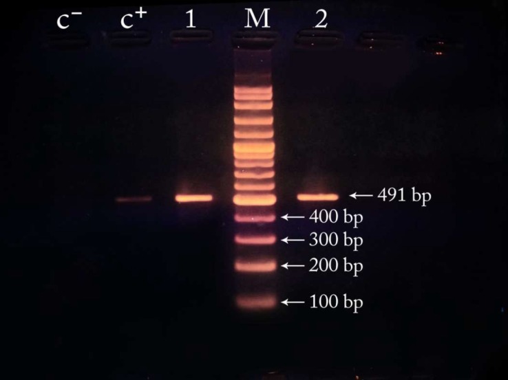 Fig .2