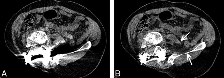 Fig 3.