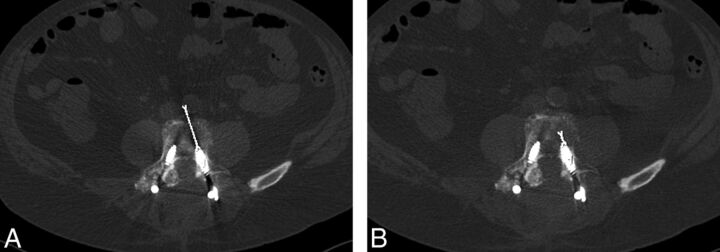 Fig 2.