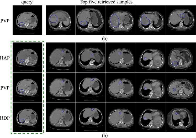 Fig. 10