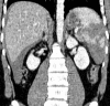 Figure 14: