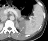 Figure 3a: