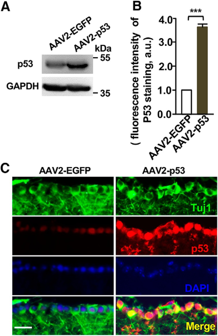 Figure 11.