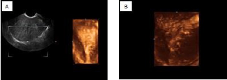 Figure 1 a, b.