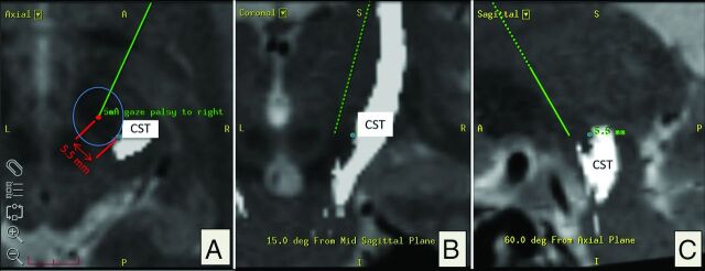 Fig 3.