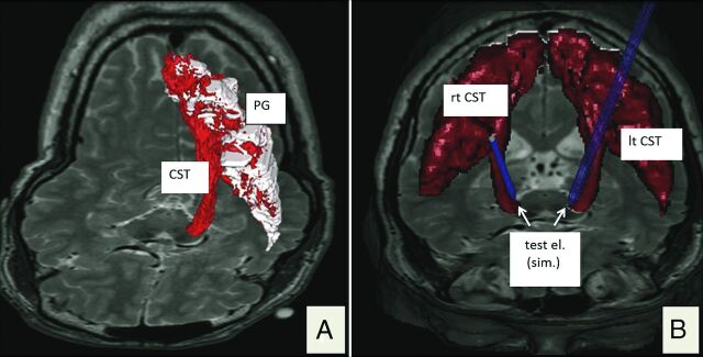 Fig 2.