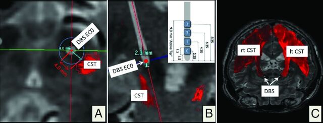 Fig 4.