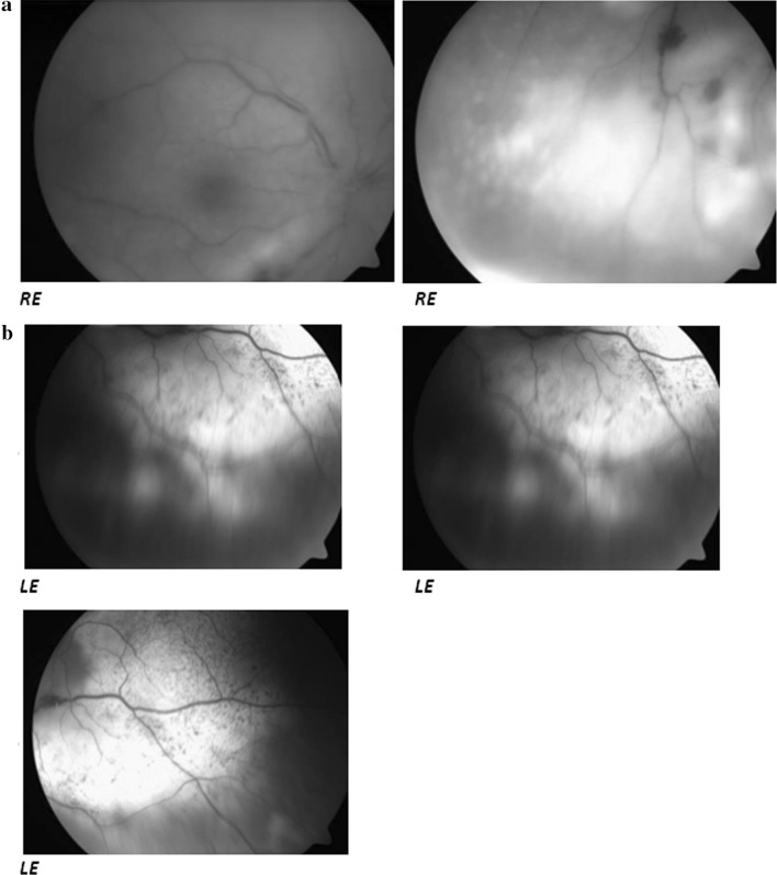 Fig. 2