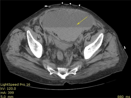 Figure 3: