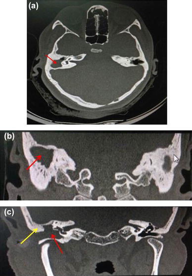 Fig. 3