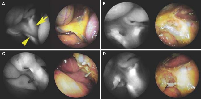 Fig. 3