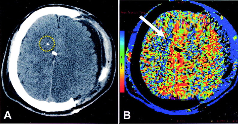 Fig 1.