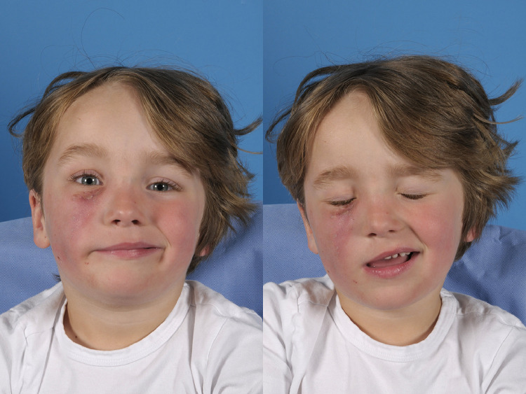 Figure 2: