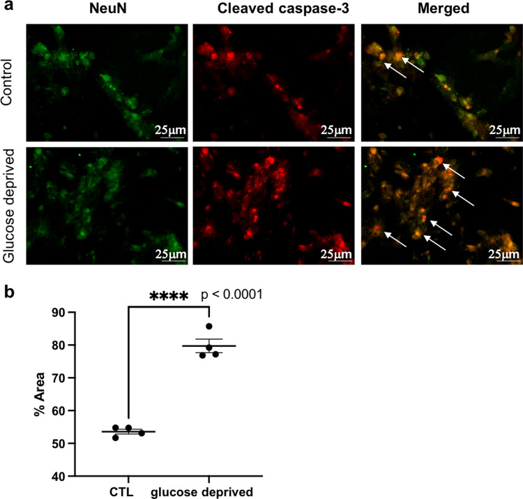 Neuronal let-7b-5p acts through the Hippo-YAP pathway in neonatal ...