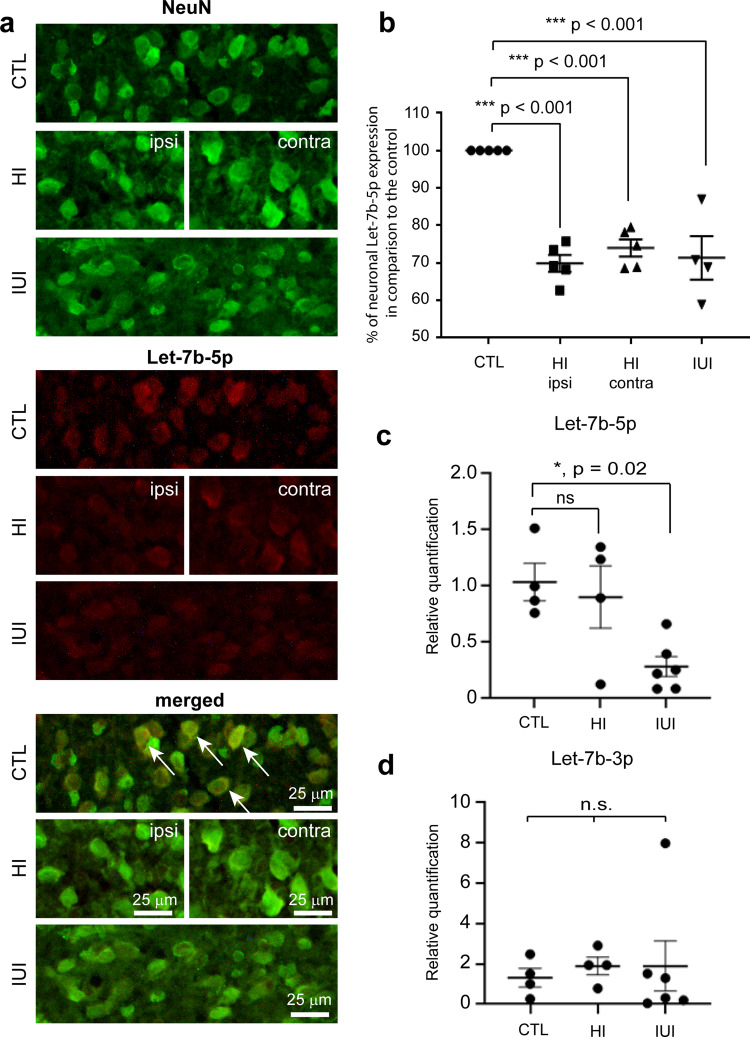 Neuronal let-7b-5p acts through the Hippo-YAP pathway in neonatal ...