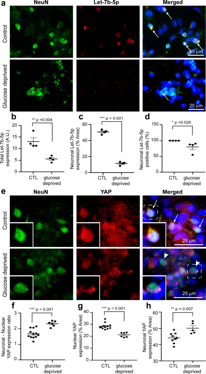 Neuronal let-7b-5p acts through the Hippo-YAP pathway in neonatal ... image.