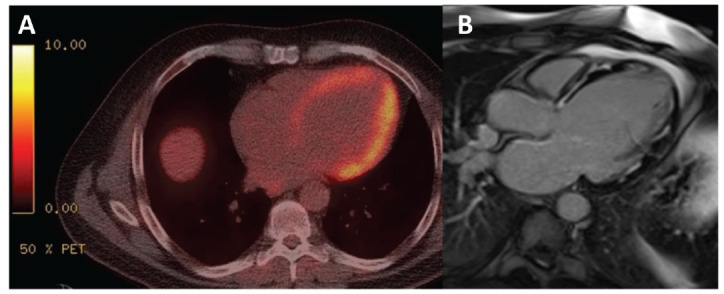 Fig. (5)