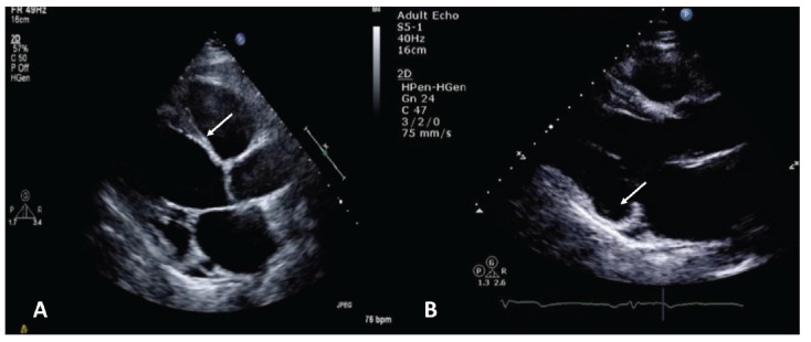 Fig. (1)