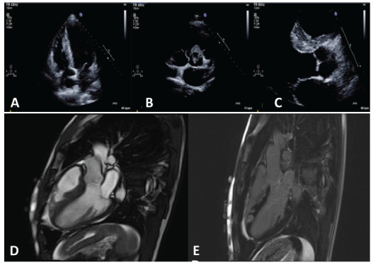 Fig. (2)