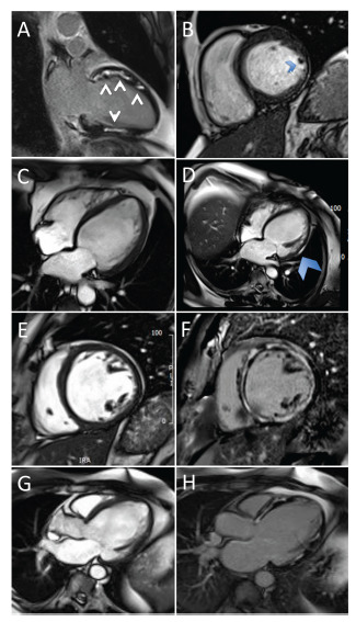 Fig. (4)