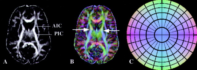 Fig 3.