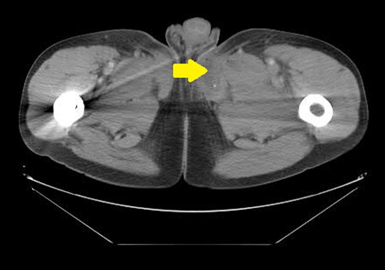 Figure 2