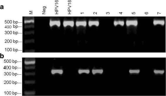 Fig. 1a