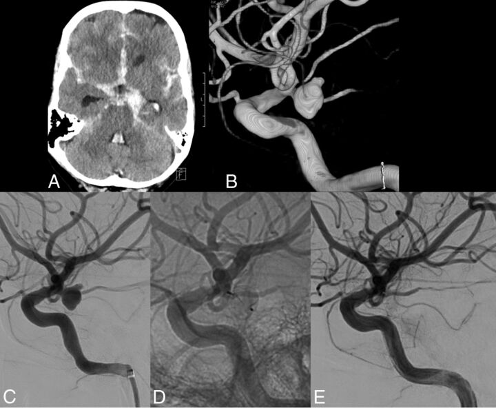 Fig 5.