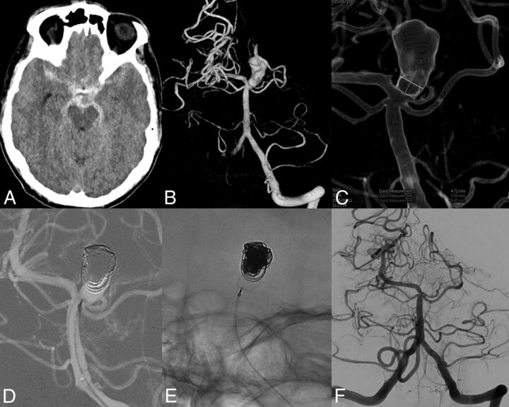 Fig 2.