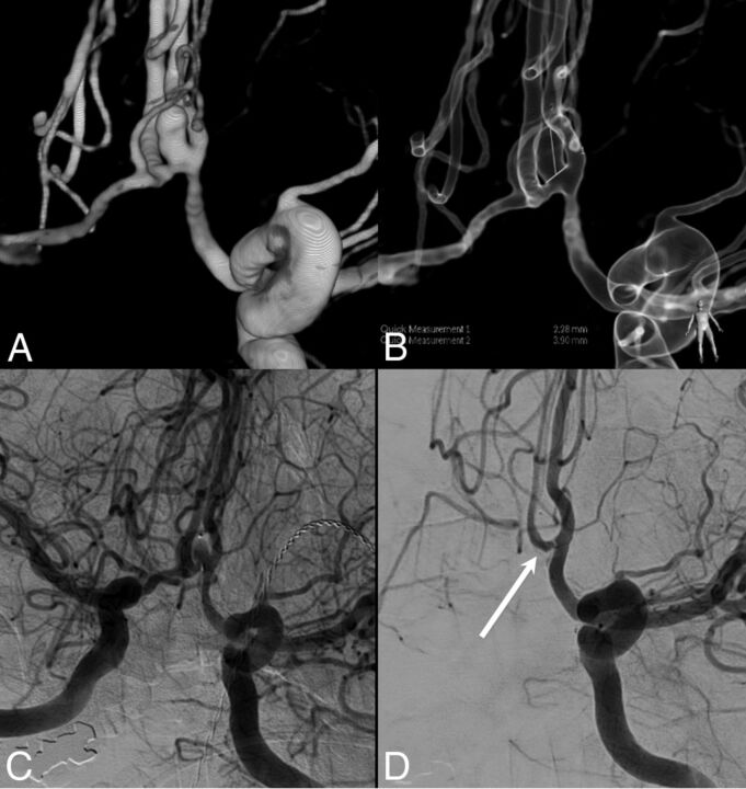 Fig 3.