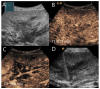 Figure 17