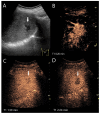 Figure 11