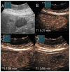 Figure 19
