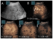 Figure 22