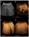 Figure 20