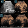 Figure 15