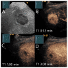 Figure 21