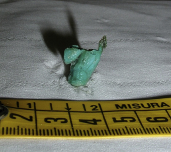 Fig. 2
